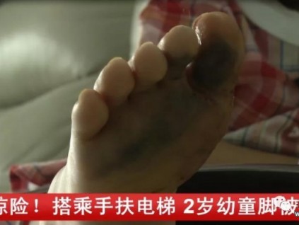 危險！2歲幼童搭乘手扶電梯，腳被卡進縫隙……